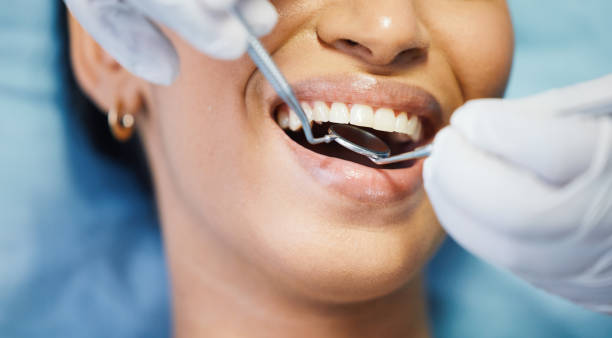 Best Emergency Dentist for Knocked-Out Tooth in Southlake, TX
